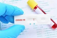 COVID ANTIBODY RESULTS PUZZLE MEDICAL EXPERTS