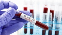 COVID-19 Testing Update