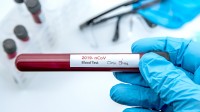 COVID-19 Testing Update 20 October 2020