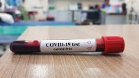 3 Positive Covid 19 cases reported, 1187 in Isolation