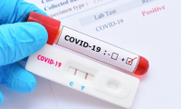 6 Positive Covid 19 cases reported on Monday