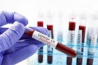 3 Positive COVID 19 tests reported today