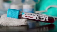 3 Positive COVID-19 cases reported today