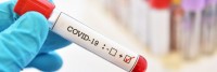Twelve positive COVID 19 cases reported Monday