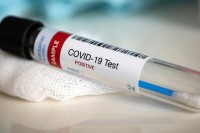 8 Positive COVID 19 tests reported