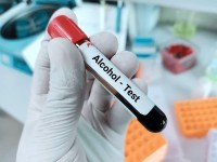 HSA Statement: Media reports on blood alcohol testing matter