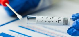 NEW ‘AMERICAN COVID’ STRAIN BEING MONITORED