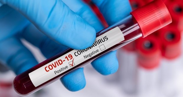 7 New positive COVID - 19 tests reported today