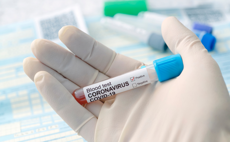 One Positive case found from Routine Screening on Island