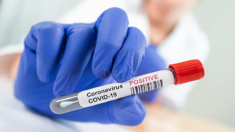 2 more Positive Covid cases detected