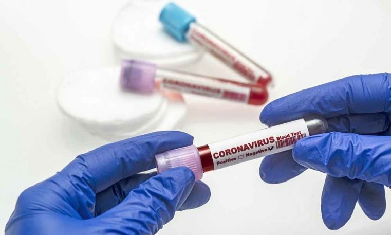 2 positive COVID cases reported  on Friday