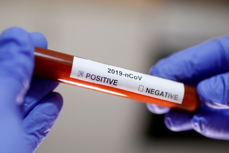 2 Positive COVID 19 cases reported Friday