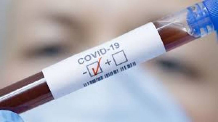 2 Positive COVID 19 tests reported on Monday