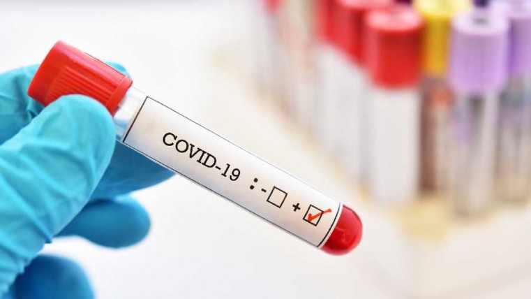 3 Positive Covid 19 cases reported today