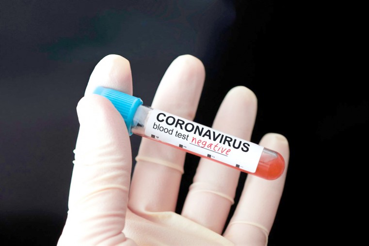 Public Health confirms no threat to public health