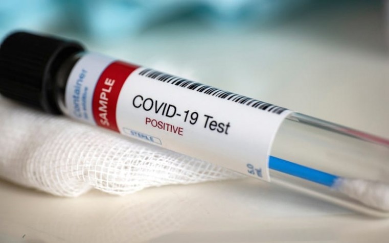 5 Positive COVID 19 tests reported today