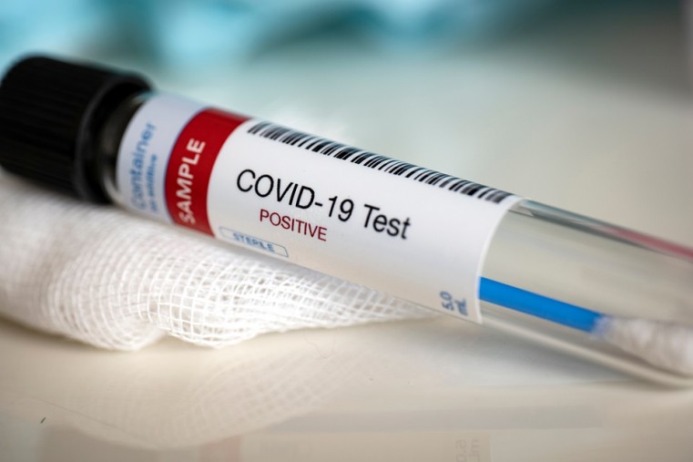 West Bay Post Office Staffer Tests Positive for COVID-19